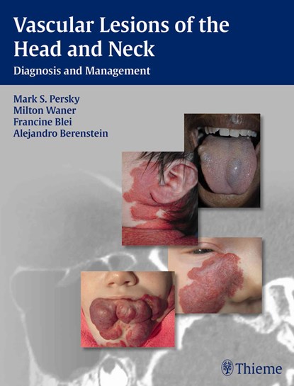 Vascular Lesions of the Head and Neck, Mark S. Persky ; Milton Waner ; Francine Blei - Gebonden - 9781604060591