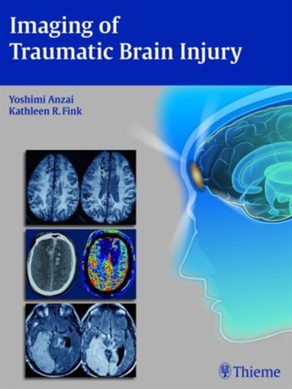 Imaging of Traumatic Brain Injury, Yoshimi Anzai ; Kathleen R Fink - Gebonden - 9781604067286