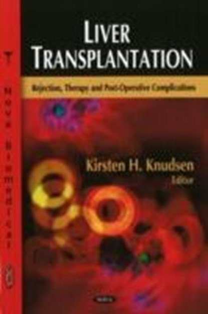 Liver Transplantation, niet bekend - Gebonden - 9781604569759