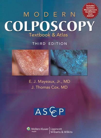 Modern Colposcopy Textbook and Atlas, American Society for Colposcopy and Cervical Pathology - Gebonden - 9781608315475