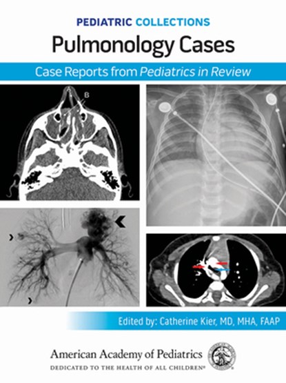 Pediatric Collections: Pulmonology Cases: Case Reports from Pediatrics in Review, American Academy of Pediatrics (Aap) - Paperback - 9781610028165