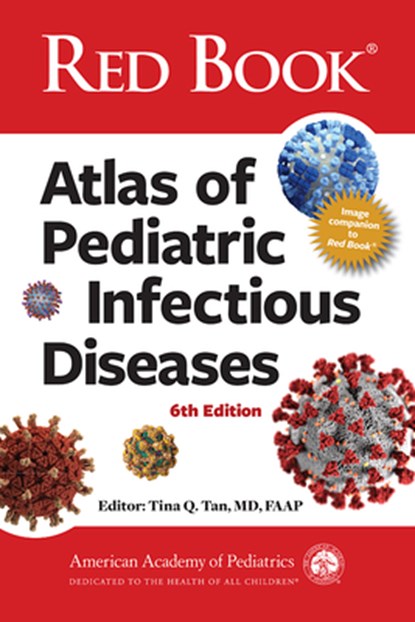Red Book Atlas of Pediatric Infectious Diseases, American Academy of Pediatrics (Aap) - Gebonden - 9781610028226