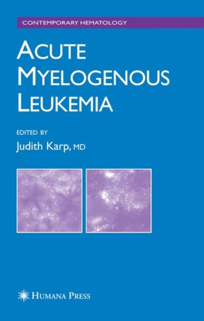 Acute Myelogenous Leukemia, Judith E. Karp - Paperback - 9781617376757