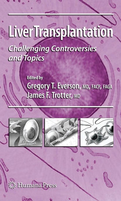 Liver Transplantation, Gregory T. Everson ; James F. Trotter - Paperback - 9781617377822