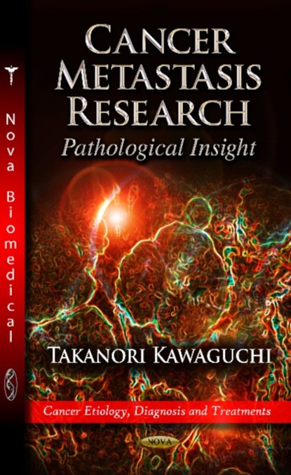 Cancer Metastasis Research, Takanori Kawaguchi - Gebonden - 9781619428638