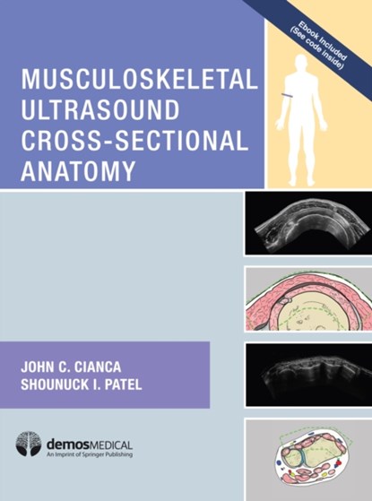 Musculoskeletal Ultrasound Cross-Sectional Anatomy, JOHN C.,  MD Cianca ; Shounuck I. Patel - Gebonden - 9781620700624