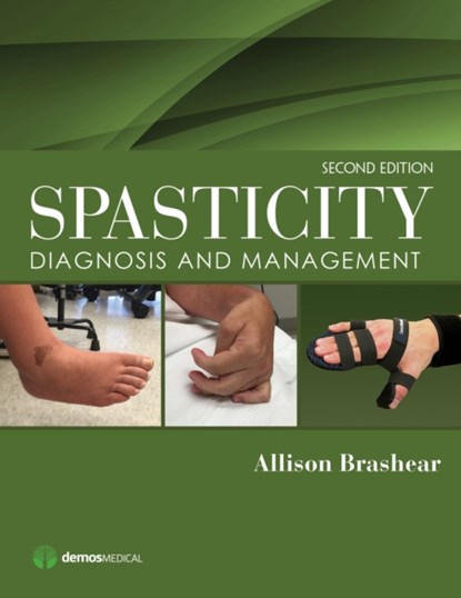 Spasticity, Allison Brashear - Gebonden - 9781620700723