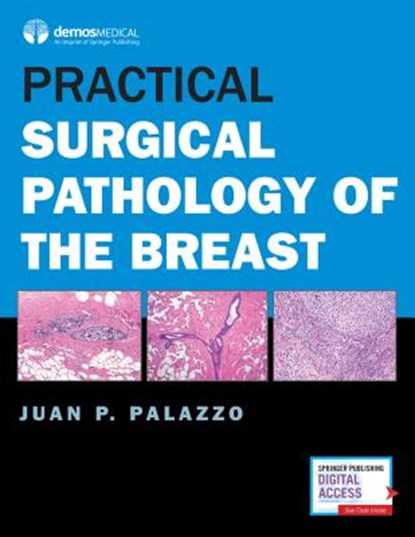 Practical Surgical Pathology of the Breast, Juan P. Palazzo - Gebonden - 9781620701058