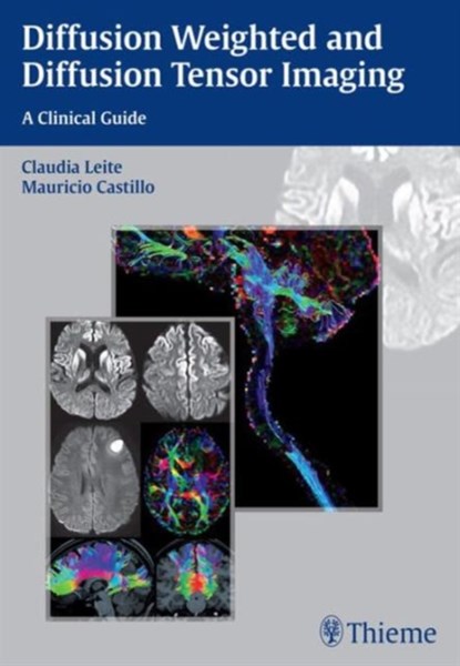 Diffusion Weighted and Diffusion Tensor Imaging, Claudia Leite ; Mauricio Castillo - Paperback - 9781626230217