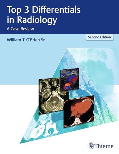 Top 3 Differentials in Radiology, William T. O'Brien - Gebonden - 9781626232785
