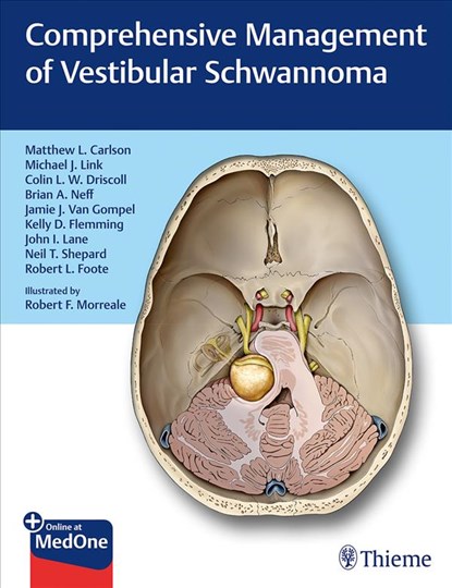Comprehensive Management of Vestibular Schwannoma, Matthew L. Carlson ; Colin L.W. Driscoll ; Michael J. Link - Gebonden - 9781626233317