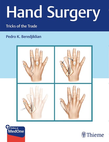 Hand Surgery, Pedro Beredjiklian - Gebonden - 9781626234796