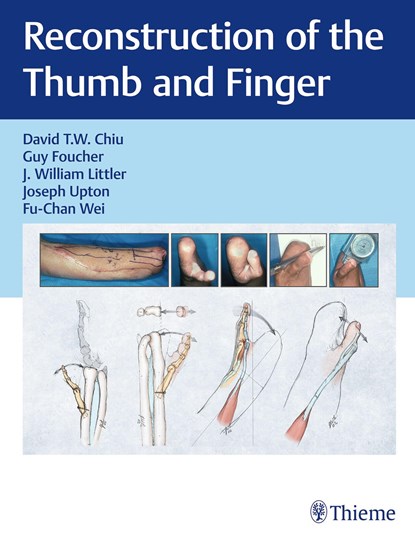 Reconstruction of the Thumb and Finger, David Chiu ; Guy Foucher ; J. William Littler - Gebonden - 9781626235748