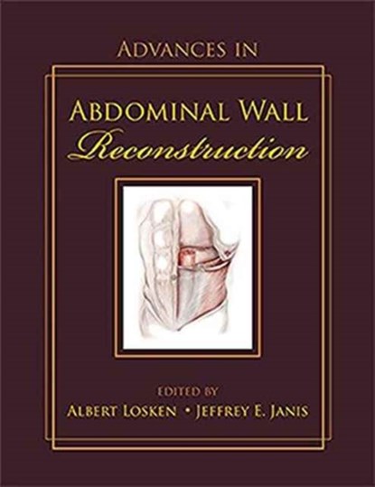 Advances in Abdominal Wall Reconstruction, Albert Losken ; Jeffrey Janis - Gebonden - 9781626236189