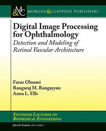 Digital Image Processing for Ophthalmology, OLOUMI,  Faraz ; Rangayyan, Rangaraj M. ; Ells, Anna L. - Paperback - 9781627054300