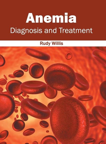 Anemia: Diagnosis and Treatment, Rudy Willis - Gebonden - 9781632414205
