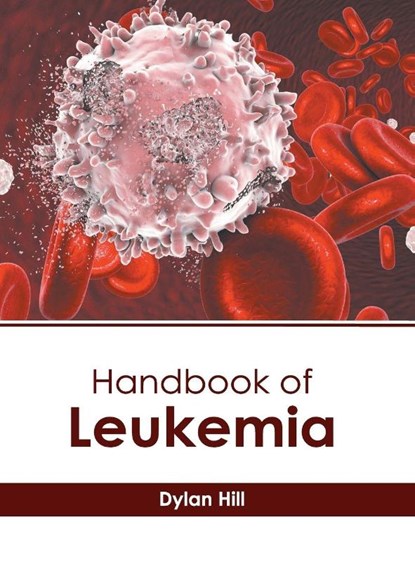 Handbook of Leukemia, Dylan Hill - Gebonden - 9781632416995