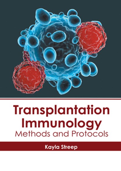 Transplantation Immunology: Methods and Protocols, Kayla Streep - Gebonden - 9781632418692