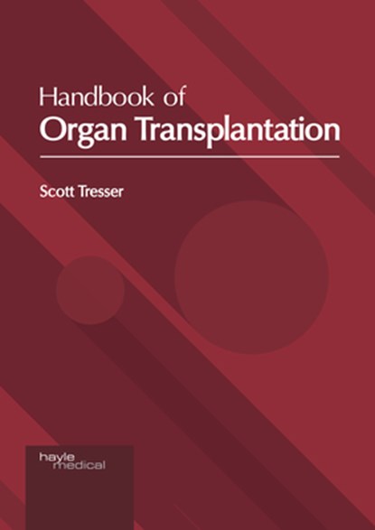Handbook of Organ Transplantation, Scott Tresser - Gebonden - 9781632418845