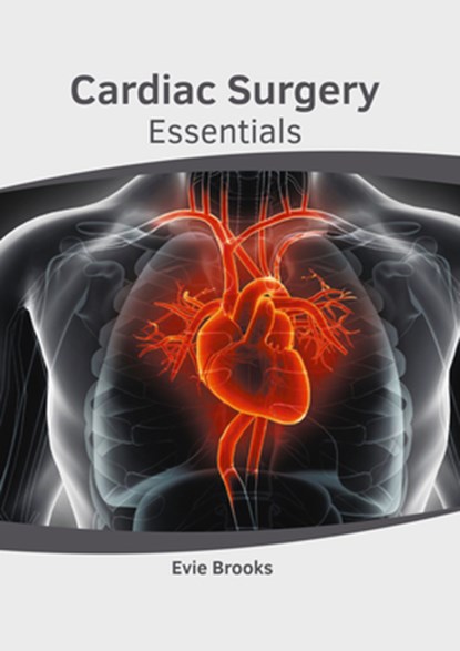 Cardiac Surgery Essentials, Evie Brooks - Gebonden - 9781632419200