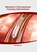 Advances in Percutaneous Coronary Interventions, Eva Barnes - Gebonden - 9781632419279
