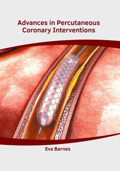 Advances in Percutaneous Coronary Interventions, Eva Barnes - Gebonden - 9781632419279