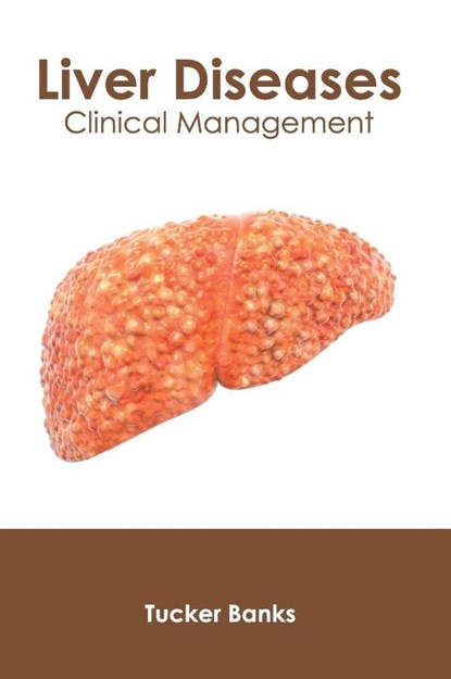 Liver Diseases: Clinical Management, Tucker Banks - Gebonden - 9781632426833