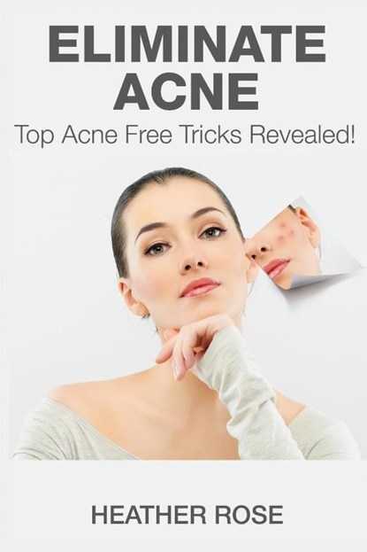 Eliminate Acne, Heather Rose - Paperback - 9781633830554
