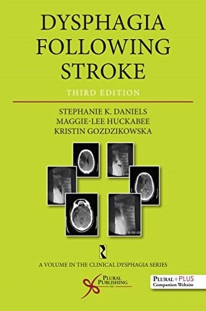 Dysphagia Following Stroke, Stephanie K. Daniels ; Maggie Lee Huckabee ; Kristin Gozdzikowska - Paperback - 9781635500301