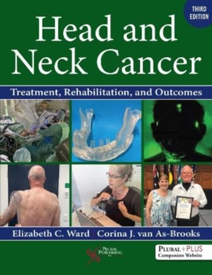 Head and Neck Cancer, niet bekend - Gebonden - 9781635506907