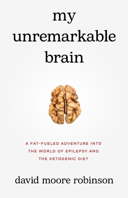 My Unremarkable Brain, David Moore Robinson - Paperback - 9781636765365