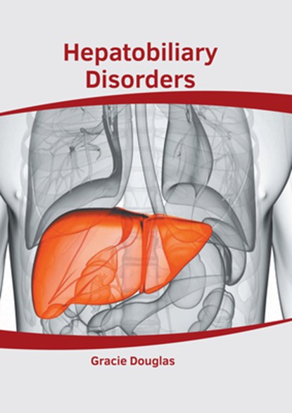 Hepatobiliary Disorders, Gracie Douglas - Gebonden - 9781639271931