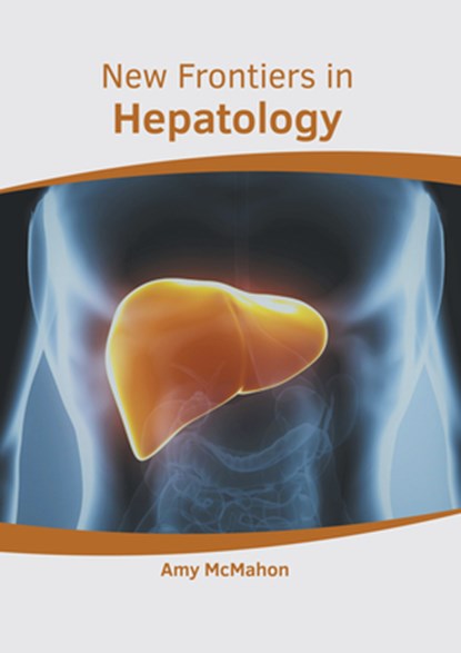 New Frontiers in Hepatology, Amy McMahon - Gebonden - 9781639271962