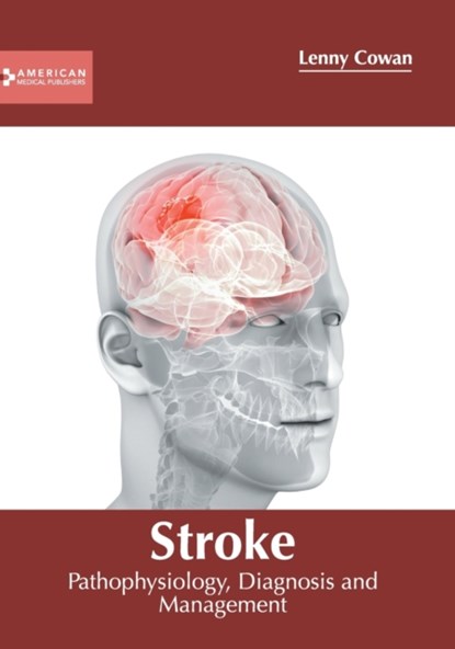 Stroke: Pathophysiology, Diagnosis and Management, Lenny Cowan - Gebonden - 9781639273317