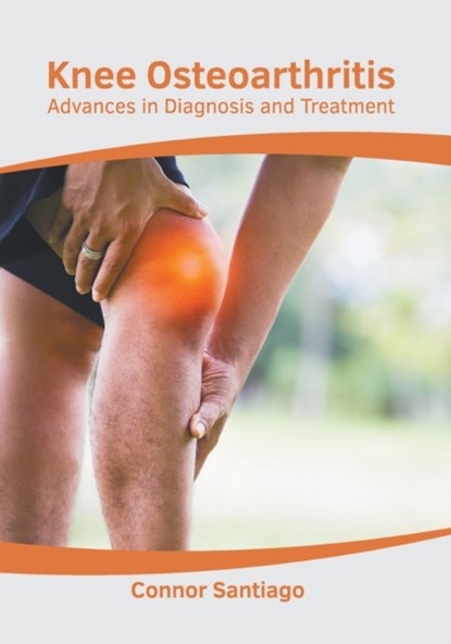 Knee Osteoarthritis: Advances in Diagnosis and Treatment, Connor Santiago - Gebonden - 9781639273973
