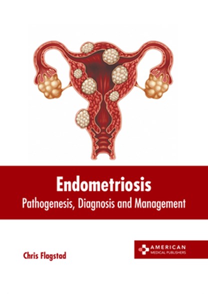 Endometriosis: Pathogenesis, Diagnosis and Management, Chris Flagstad - Gebonden - 9781639276677