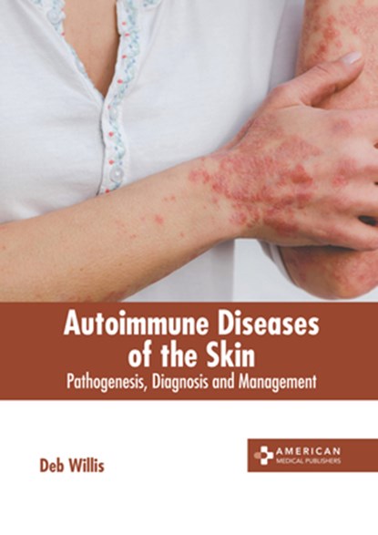 Autoimmune Diseases of the Skin: Pathogenesis, Diagnosis and Management, Deb Willis - Gebonden - 9781639279036