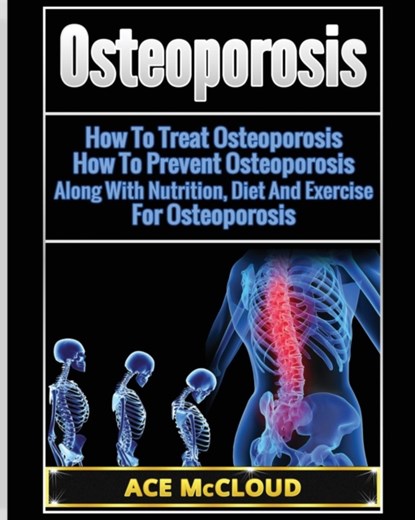 Osteoporosis, Ace McCloud - Paperback - 9781640480599