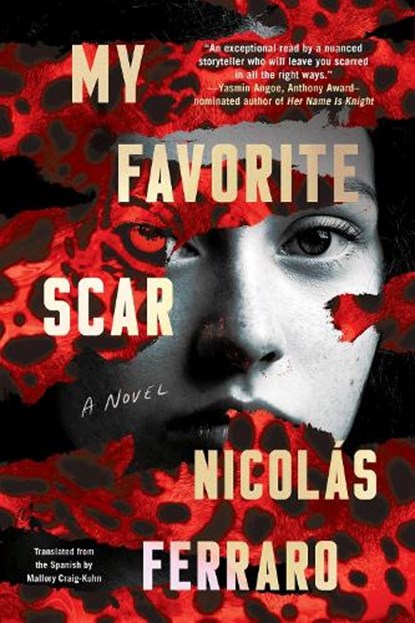 My Favorite Scar, Nicolas Ferraro ; Mallory Craig-Kuhn - Paperback - 9781641296212