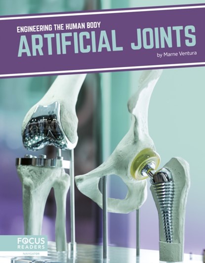 Artificial Joints, Marne Ventura - Paperback - 9781641858304
