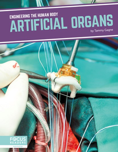 Artificial Organs, Tammy Gagne - Paperback - 9781641858311