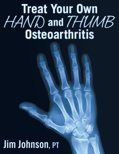 Treat Your Own Hand and Thumb Osteoarthritis, Jim Johnson - Paperback - 9781642376470