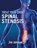 Treat Your Own Spinal Stenosis, Jim Johnson - Paperback - 9781642379587