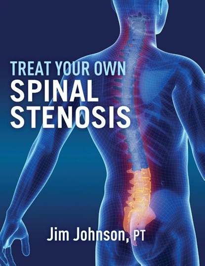 Treat Your Own Spinal Stenosis, Jim Johnson - Paperback - 9781642379587