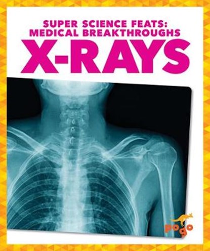 X-Rays, Alicia Z. Klepeis - Gebonden - 9781645278047