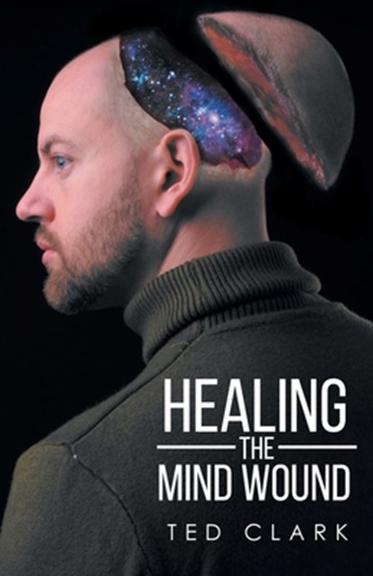 Healing the Mind Wound, Ted Clark - Paperback - 9781645690788