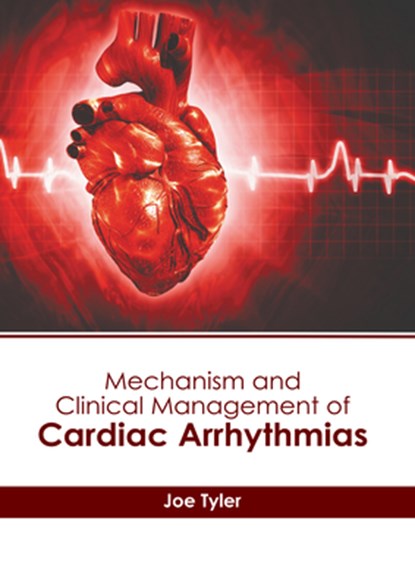 Mechanism and Clinical Management of Cardiac Arrhythmias, Joe Tyler - Gebonden - 9781646475551