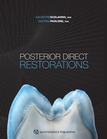Posterior Direct Restorations, Salvatore Scolavino ; Gaetano Paolone - Ebook - 9781647240042