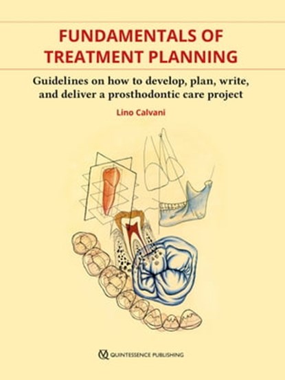 Fundamentals of Treatment Planning, Lino Calvani - Ebook - 9781647240332