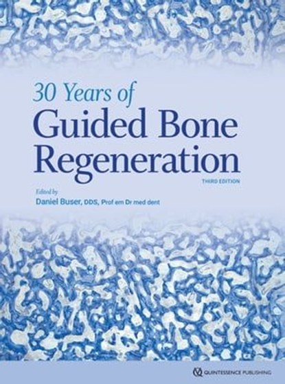 30 Years of Guided Bone Regeneration, Daniel Buser - Ebook - 9781647241346